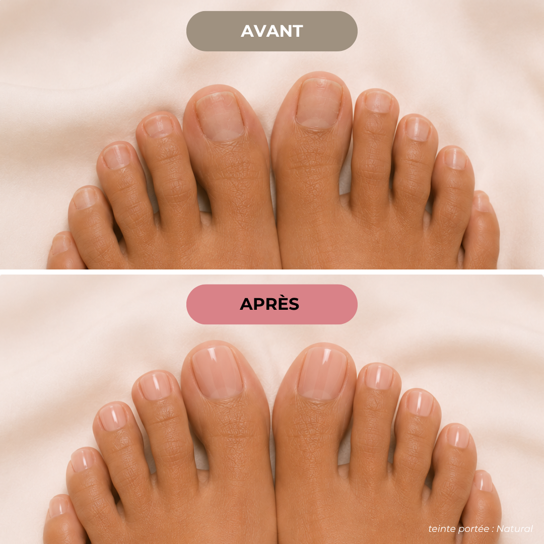 Capsules Soft Gel Premium Pieds - Natural
